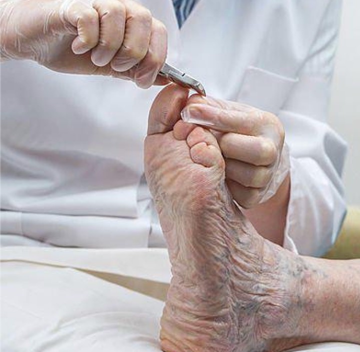 Podología para la tercera edad en A Peu Valencia